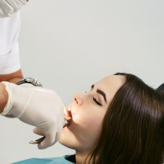Tooth Extractions in Modesto, CA 